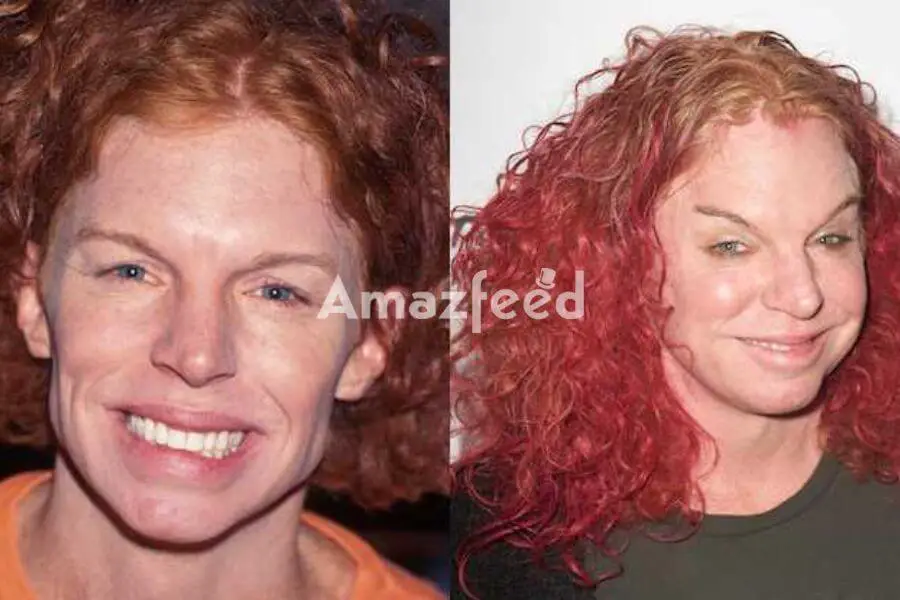 Is Carrot Top plastic surgery