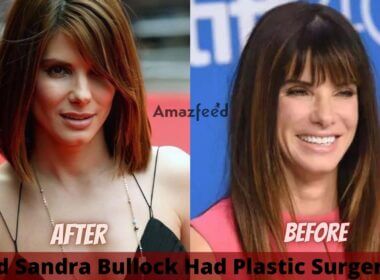 Did Sandra Bullock Had Plastic Surgery