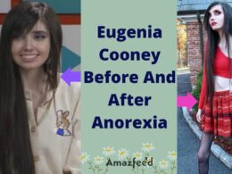 Eugenia Cooney Before And After Anorexia