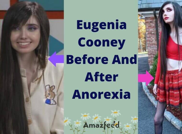 eugenia cooney before and after Archives » Amazfeed