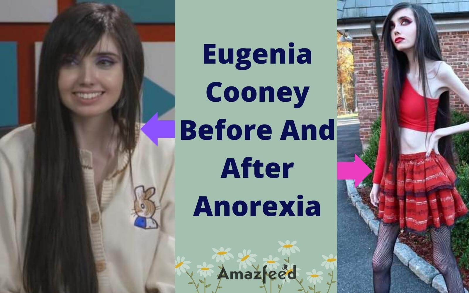 Eugenia Cooney Before And After Anorexia More About Cooney » Amazfeed