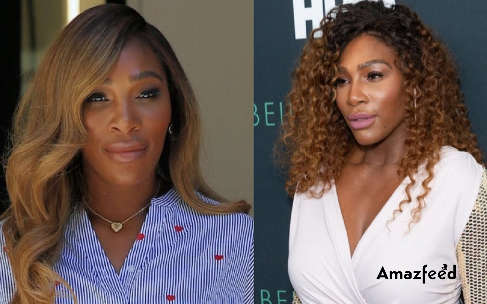 Serena Williams Plastic Surgery Before And After Look Is Serena