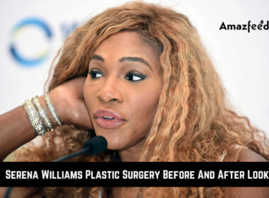 Serena Williams Plastic Surgery Before And After Look