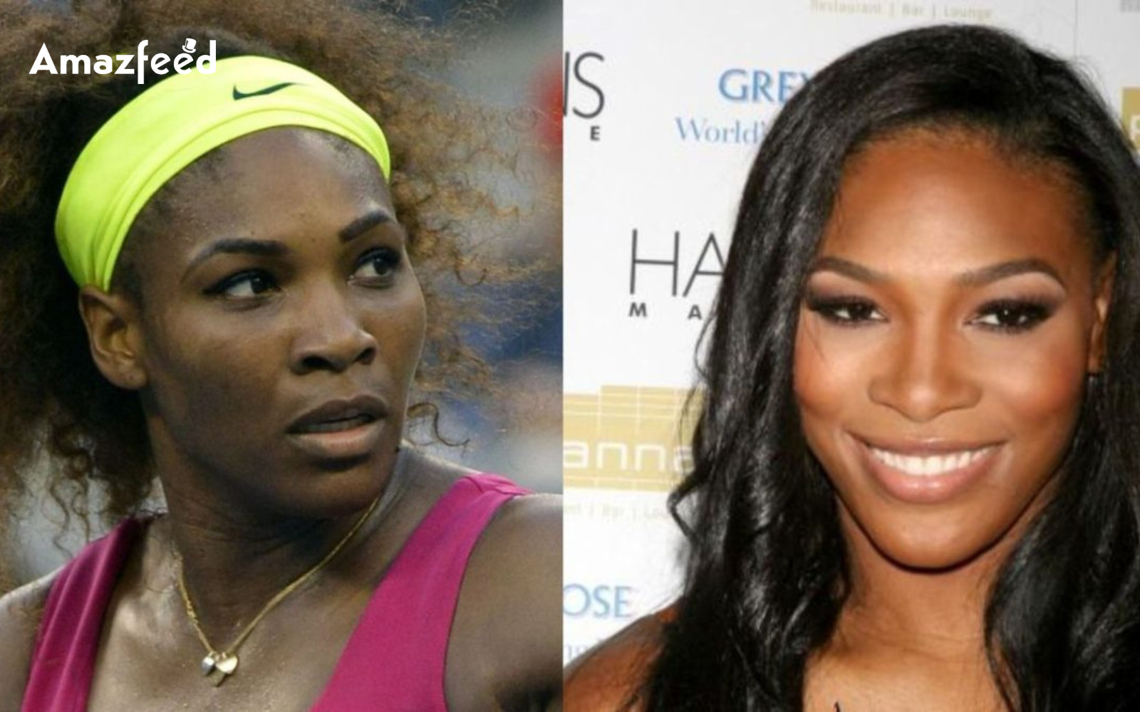 Serena Williams Plastic Surgery Before And After Look Is Serena