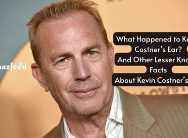 What Happened to Kevin Costner Ear